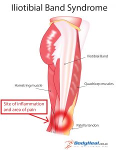 Chanhassen chiropractor knee pain